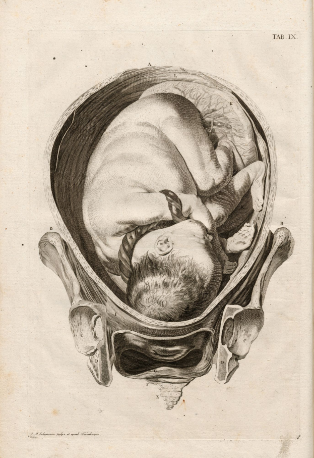 Eine Gravur eines Babys im Mutterleib, die einen menschlichen Kopf und Haare zeigt, mit begleitendem Text.